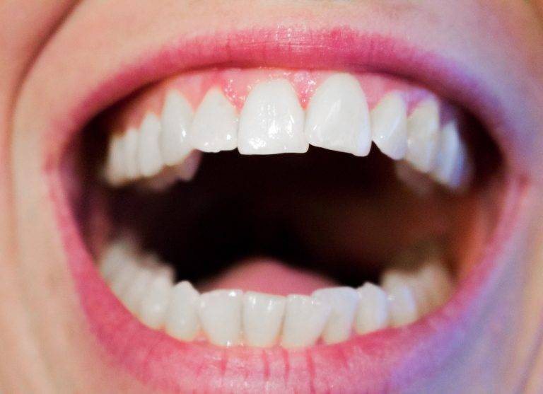 Aktualna technologia wykorzystywana w salonach stomatologii estetycznej być może spowodować, że odbierzemy śliczny uśmiech.